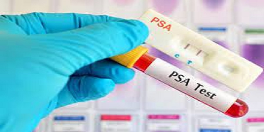 دستورالعمل آزمایش  PSA