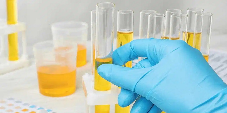 دستورالعمل آزمایش ادرار 24 ساعته  