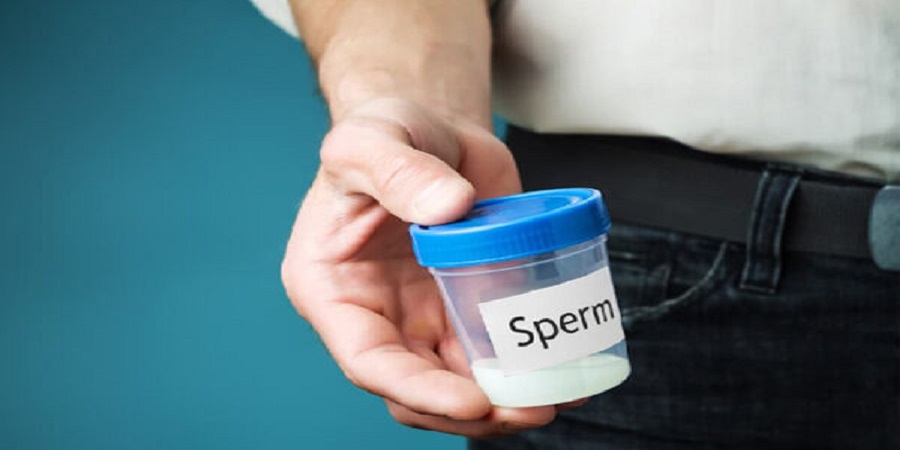 شرایط جمع آوری (مایع منی/اسپرم)