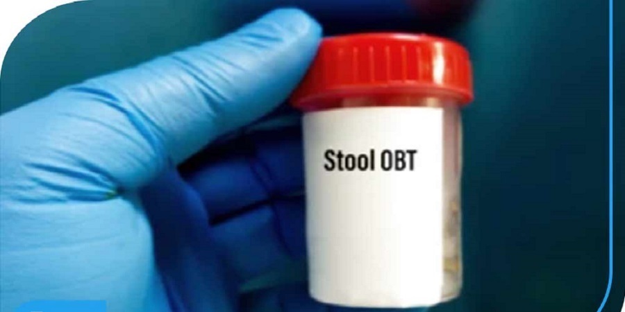 دستورالعمل آزمایش OB(خون مخفی در مدفوع)