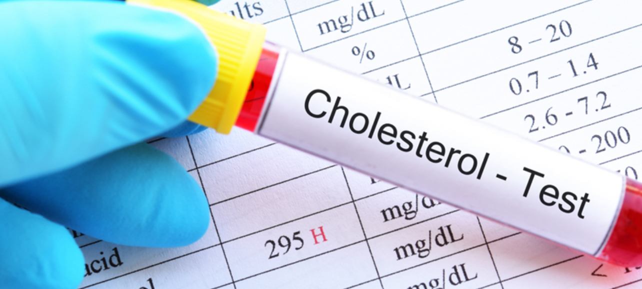 شرایط آزمایش چربی خون